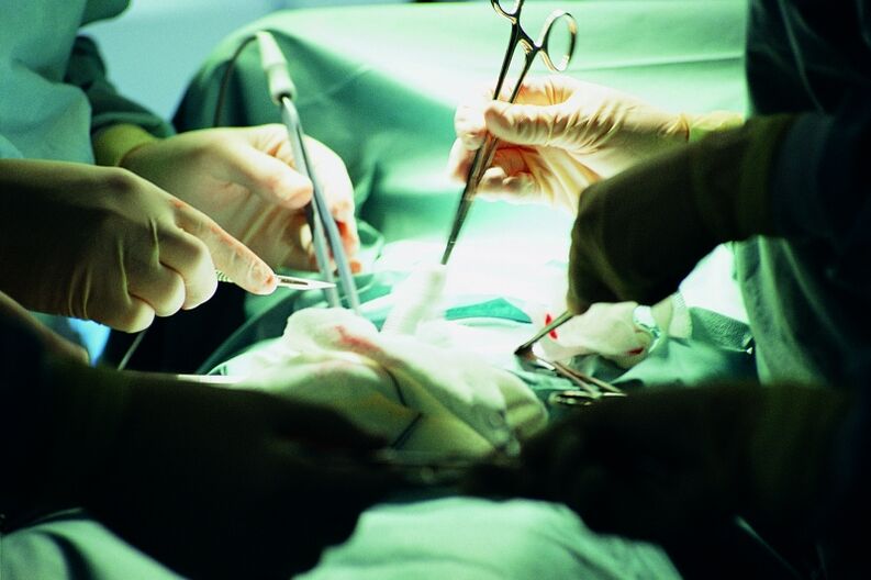 Surgery to increase penis thickness