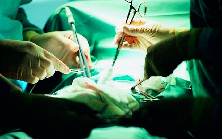 Microsurgery muscle transplantation